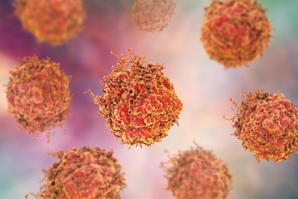 Investigadores logran aumentar la sensibilidad de las células cancerosas al tratamiento quimioterapéutico