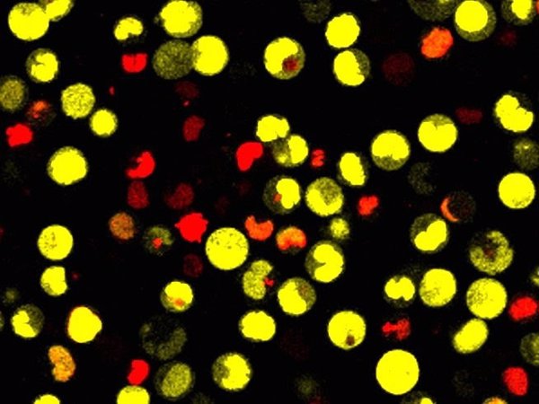 Aportan nuevos datos sobre las células madre pluripotentes, capaces de transformarse en cualquier tejido
