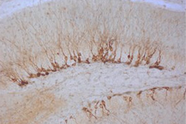 Investigadores del CSIC logran rejuvenecer regiones cerebrales de ratones mediante reprogramación celular