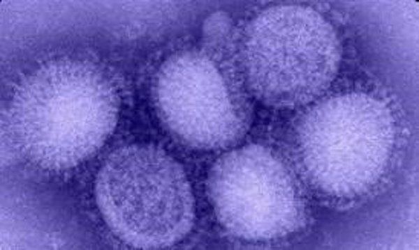 Un estudio explica la causa de las 'superinfecciones' por el virus de la gripe