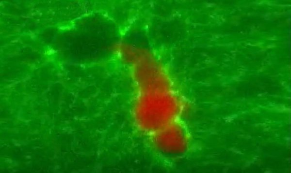 Un estudio muestra cómo los linfocitos T cavan túneles en tejidos para facilitar la llegada de 'refuerzos'