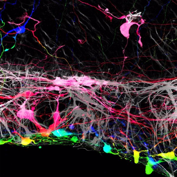 Investigadores observan que eliminar una membrana de la retina puede ayudar a reparar el nervio óptico