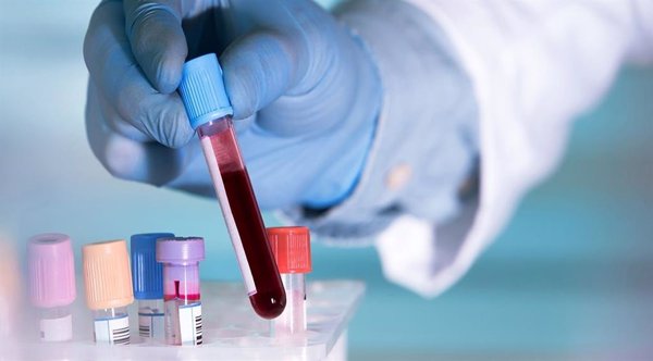 Los análisis de sangre podrían ser útiles para predecir la gravedad de la COVID-19, según un estudio