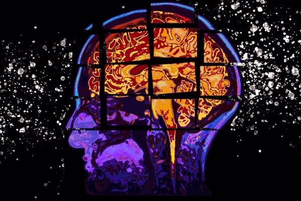 Desarrollan una inteligencia artificial que identifica fármacos ya aprobados que pueden ser útiles contra el Alzheimer