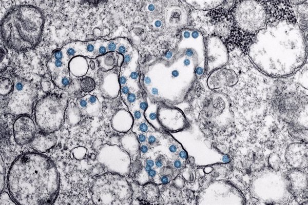 Un estudio evidencia que las células B en niños de otros coronavirus pueden proteger contra el SARS-Cov-2