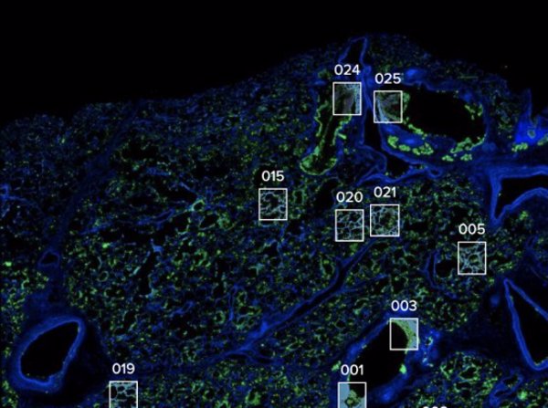 Un estudio muestra cómo los pulmones intentan repararse sin éxito frente a la COVID-19