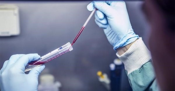 Investigadores determinan si la causa del aborto es cromosómica mediante un análisis de sangre materna