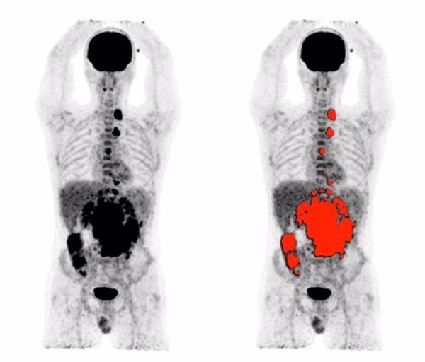 El CSIC participa en un proyecto para desarrollar un escáner PET de cuerpo entero y con mayor sensibilidad