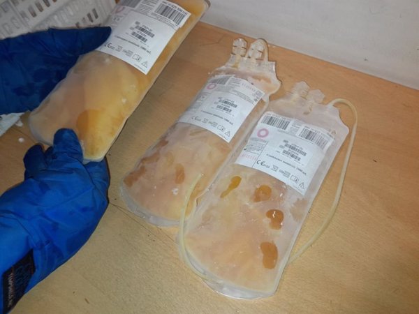 Un estudio no encuentra mucho beneficio del plasma convaleciente en pacientes con síntomas tempranos