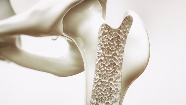 Solo uno de cada cuatro pacientes con osteoporosis o fractura por fragilidad reciente recibe tratamiento