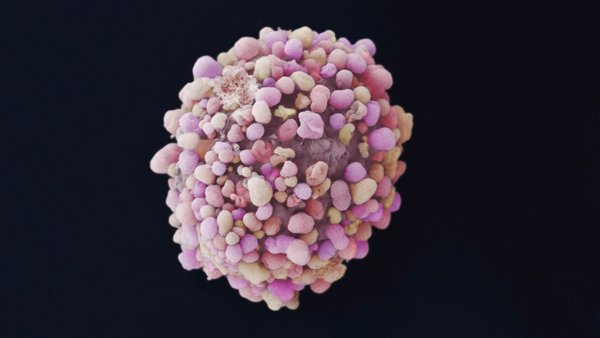 Investigadores diseñan una estrategia para identificar dianas terapéuticas en cáncer de mama triple negativo