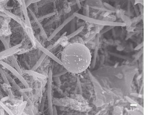 Investigadores descubren un parásito intestinal capaz de suprimir la inflamación y mejorar la salud