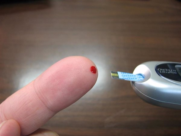 Las nuevas tecnologías y los metadatos, alternativas a la experimentación animal en la investigación de la diabetes