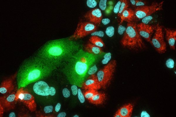 Investigadores descubren que compuestos vegetales modificados químicamente funcionan contra el virus de la hepatitis E