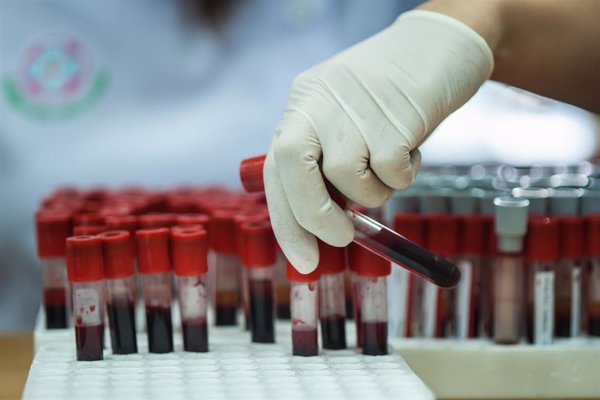 Más del 70% de los pacientes con hemofilia grave viven sin hemorragias en un año gracias a las terapias actuales