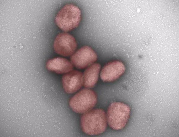 Un estudio del CSIC muestra la presencia del virus de la viruela del mono en el aire de pacientes infectados