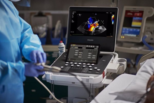 Philips lanza un nuevo sistema de ultrasonidos que permite diagnosticar a más pacientes a la primera