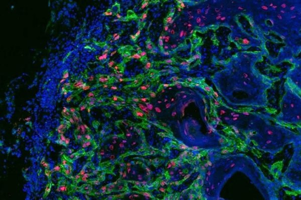 Un estudio descubre que las células madre del cáncer se alimentan a través del diálogo con su entorno