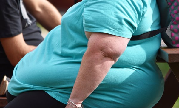 Los enfermeros alertan de que los mayores con obesidad pueden estar desnutridos
