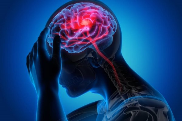 Uno de cada cinco pacientes con diagnóstico clínico de epilepsia no controlada realmente no la padece