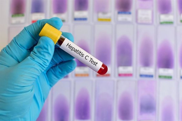 Un estudio remarca la necesidad de vigilar el VIH y la hepatitis C entre los consumidores de drogas inyectables