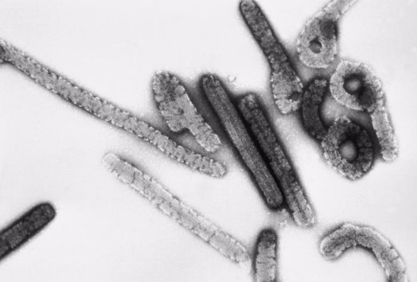 Sanidad confirma la puesta en marcha del protocolo de fiebre hemorrágica en Donostia ante un posible caso de ébola