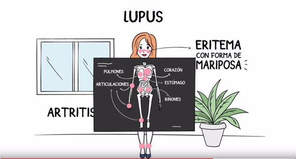 Reumatólogos advierten sobre la importancia de la vacunación en pacientes con lupus