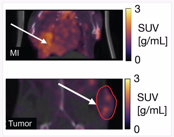 Estudio del CNIC sobre el uso de PET para detectar macrófagos, Artículo del Año 2024 por la revista 'Nature PJ Imaging'