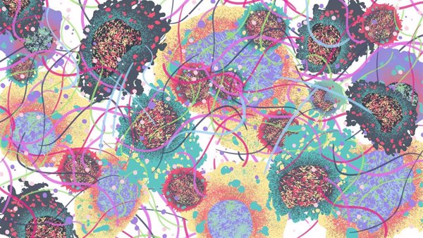 Un estudio revela cómo los carcinomas orales suprimen la respuesta inmunitaria