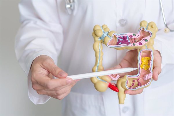 El aumento de la incidencia de la colitis ulcerosa o de la enfermedad de Crohn podría explicarse por la alimentación