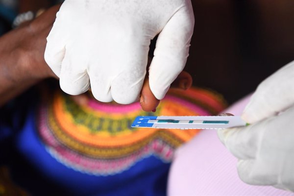 Un estudio constata que una terapia frente al VIH con dos fármacos mantiene una eficacia similar a otra con tres