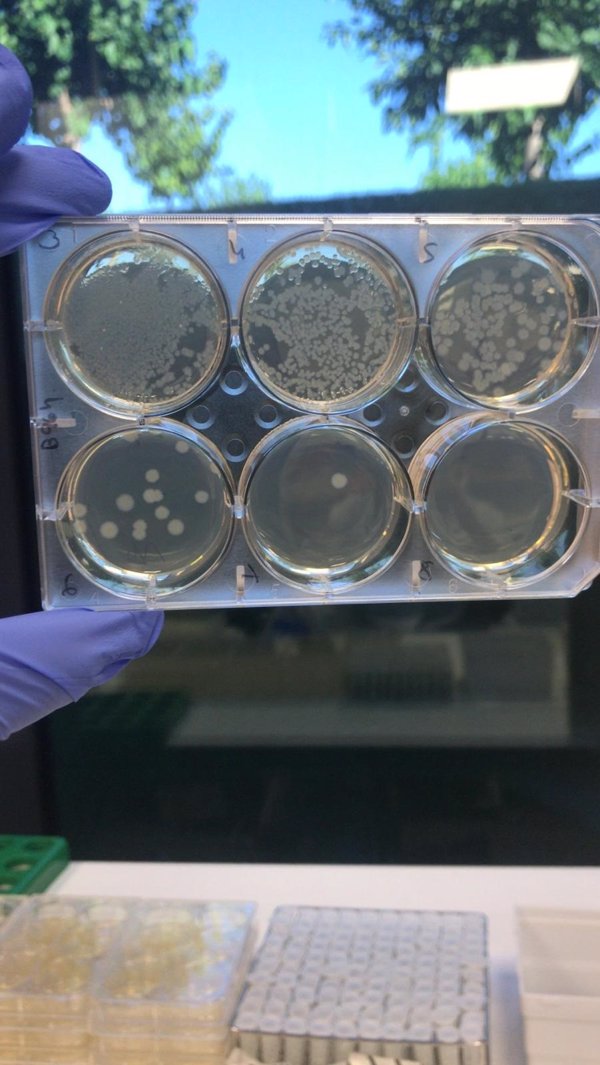Un estudio demuestra cómo las bacterias usan sensores de fuerza para colonizar huéspedes