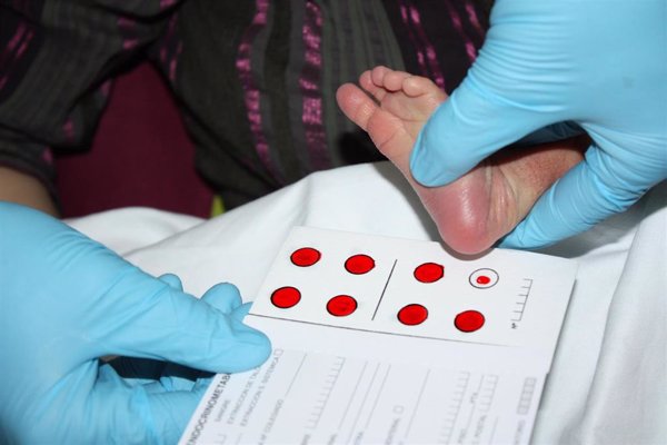 FEDER alerta de la inequidad por CCAA en el acceso a las pruebas para detectar enfermedades en los recién nacidos