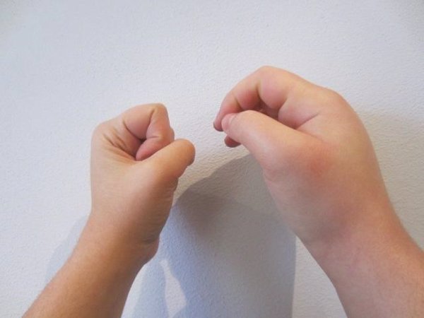 Alergólogo advierte que la naturaleza impredecible del angioedema hereditario impacta en el bienestar de los pacientes