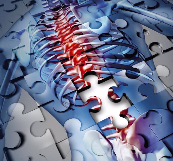 Neurocirujano destaca las ventajas de los implantes dinámicos para estenosis de canal lumbar al preservar la movilidad