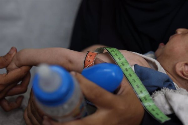 MSF alerta de que los niveles de desnutrición están en